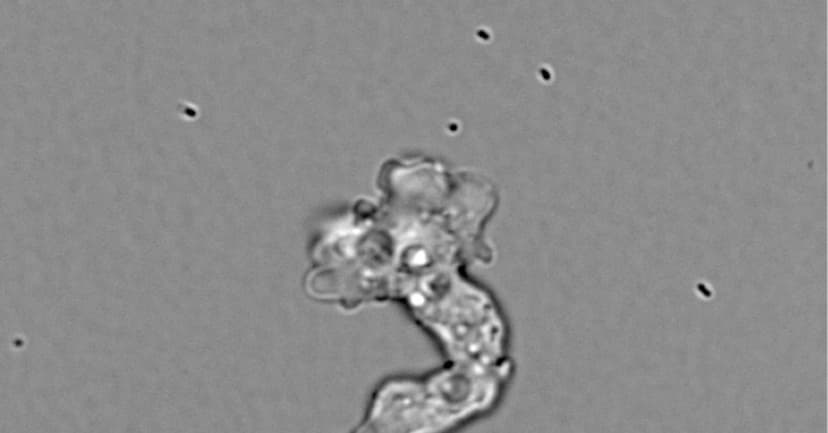 Extreme Amoeba Thrives in Boiling Springs