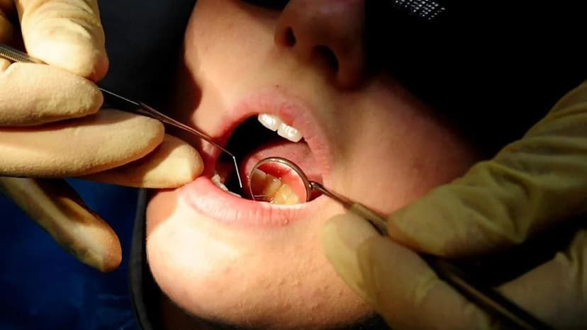 NHS Dentist Golden Hello Fails to Attract Staff