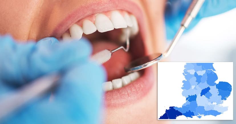 NHS Dentistry Lost: 600 Practices Go Private