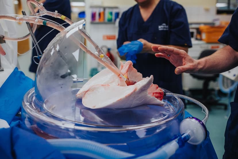 NHS Trial Boosts Organ Transplants by 19%