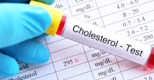 Cholesterol Numbers Lie: Your Heart Risk Deeper