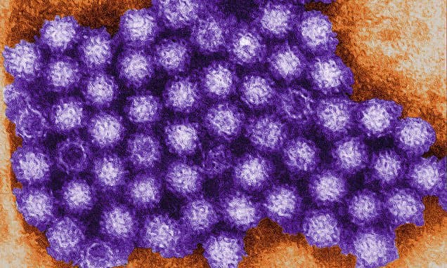 Norovirus Surges: Ireland Faces 54% Case Increase