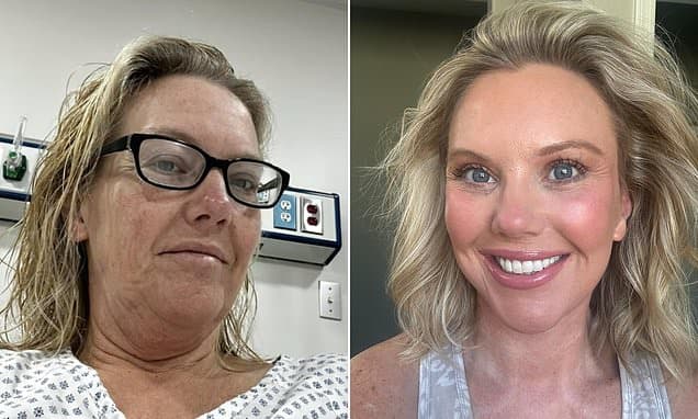 Nurse's Facelift Transformation: From Confidence Crisis to Radiant Rebirth