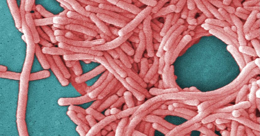 NYC Outbreak: 11 Dead, 94 Sickened by Legionnaires'