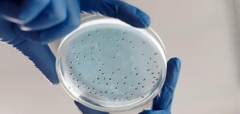 14 Cases of Legionnaires' Erupt on Upper East Side