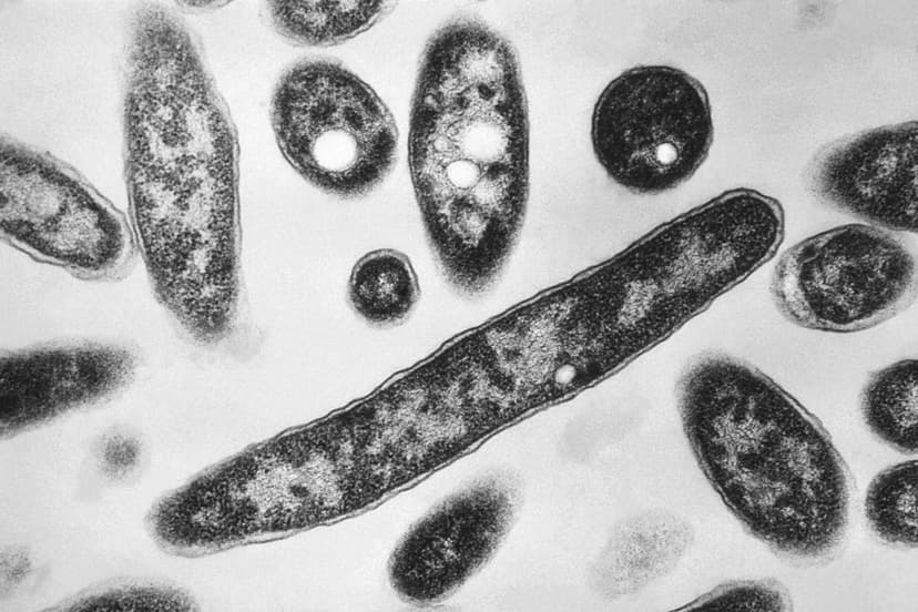 NYC Legionnaires' Cases Slow, Source Hunt Continues