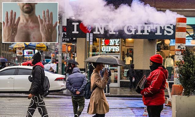 NYC Confirms First Severe Mpox Strain Case