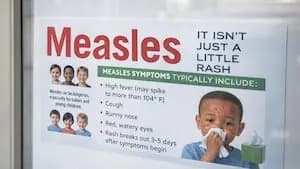 Ohio Battles Growing Measles Outbreak: 4 Counties Affected