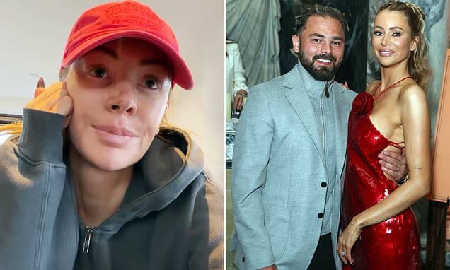 Olivia Attwood: Straitjacket Needed Amidst Split Woes