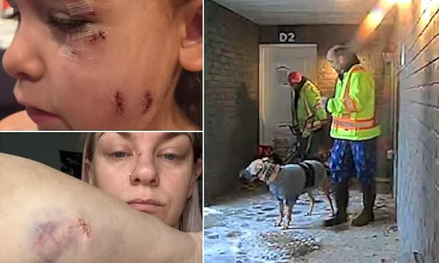 Dog Attack Horror: Mom and Child Mauled by Neighbors' Pets