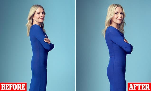 Ozempic's Unwanted Gift: The 'Deflated Soufflé' Bum