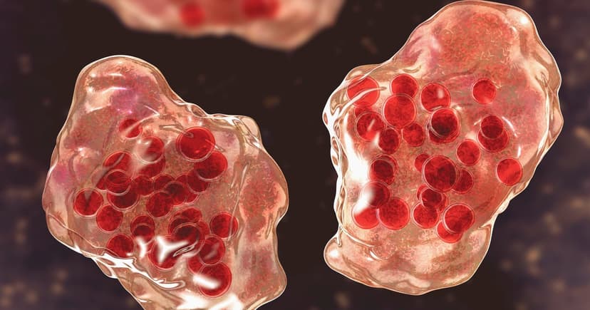 Unvaccinated Resident Dies from Measles