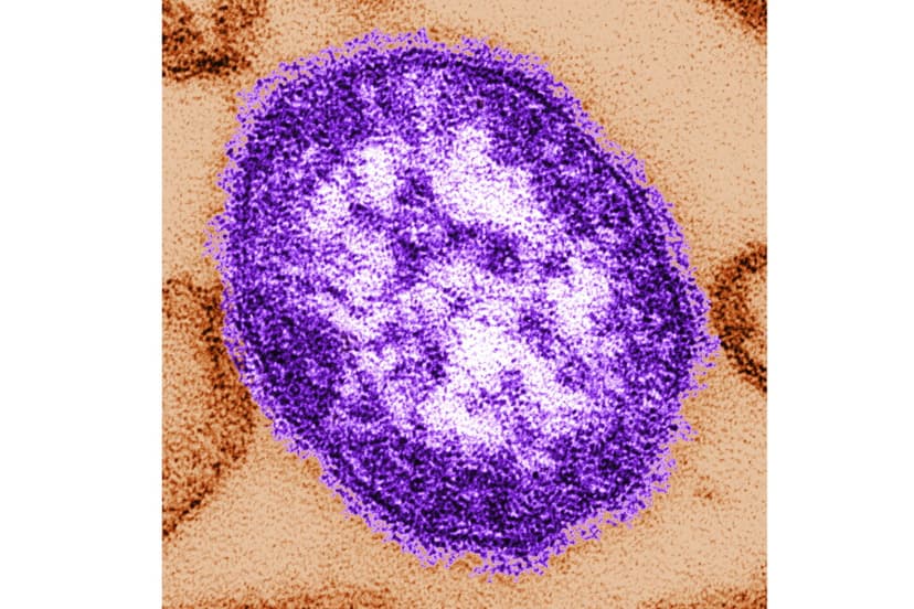 Measles Claims Third Life in Pennsylvania This Year