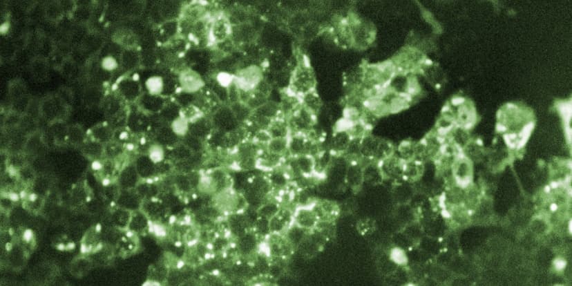 Pennsylvania Measles Deaths Climb to Five
