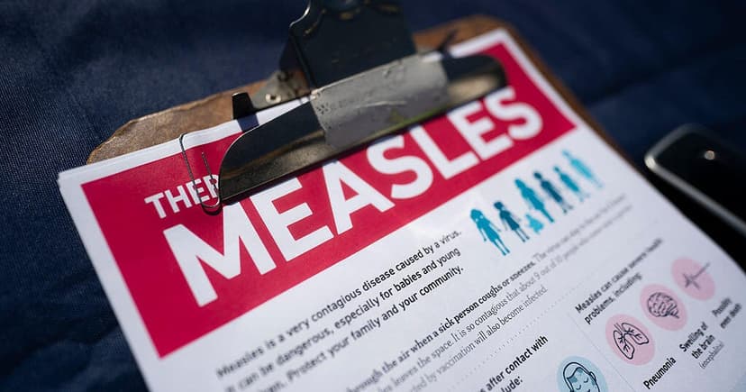 Measles Outbreak in Placer County Linked to SC Cases