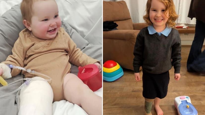 Chickenpox Ignored: Mother's Warning Leads to Daughter's Lifelong Disabilities