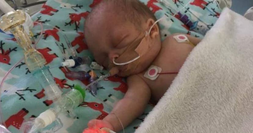 Premature Baby's Fight for Life After Discharge