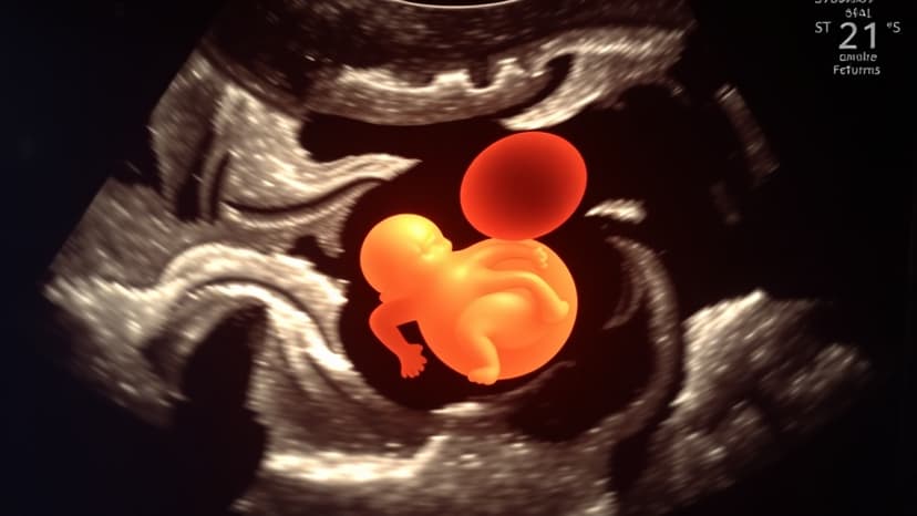 Woman's Tragedy After False Ultrasound Results