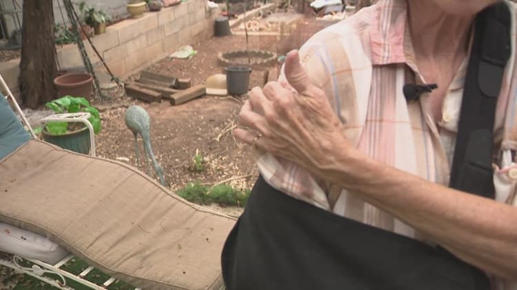 Rabid Fox Attack Leaves Woman Injured, Arm Fractured