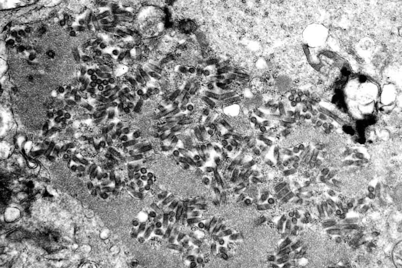 US Warns of Rabies Outbreaks: Wildlife and Pets Infected