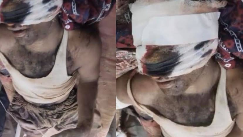Brutal Attack in Rajasthan: Man Mutilated by Relatives