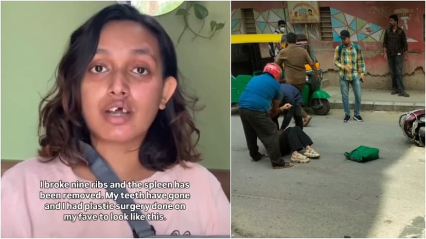 Bike Taxi Horror: Designer Critically Injured, Company Accused