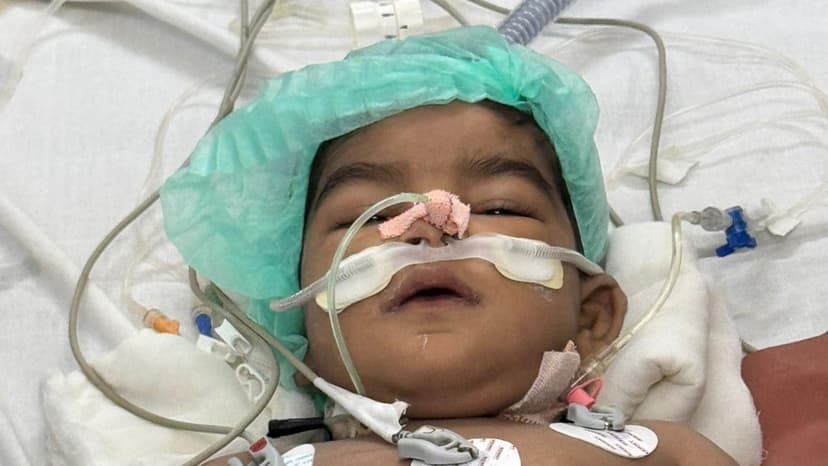 Baby Survives Rare Liver Transplant, Saved by Aarogyasri Scheme