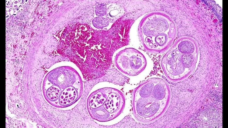 Deadly Rat Worm Found West of Texas First Time