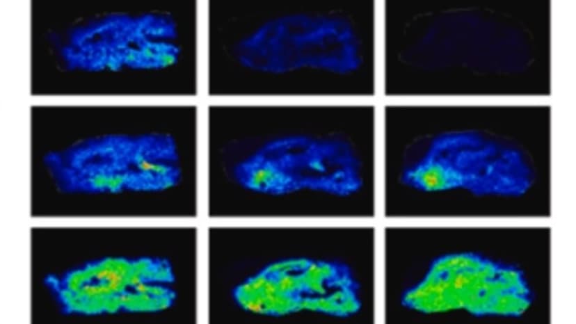 Red Wine & Chocolate: Brain Exercise In A Bite?