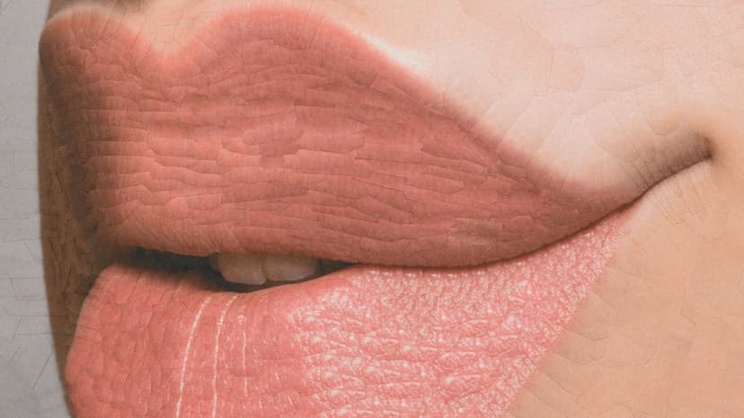 Cosmetic Procedures Overtake Fashion for the Ultra-Wealthy