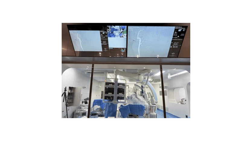 Robotic Surgery Revolutionizes Stroke Treatment