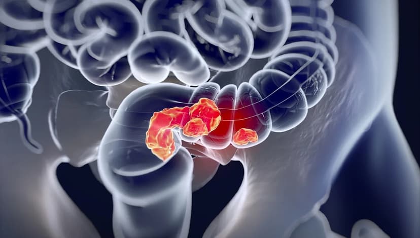 Robotic Surgery Achieves Perfect Resection Rates