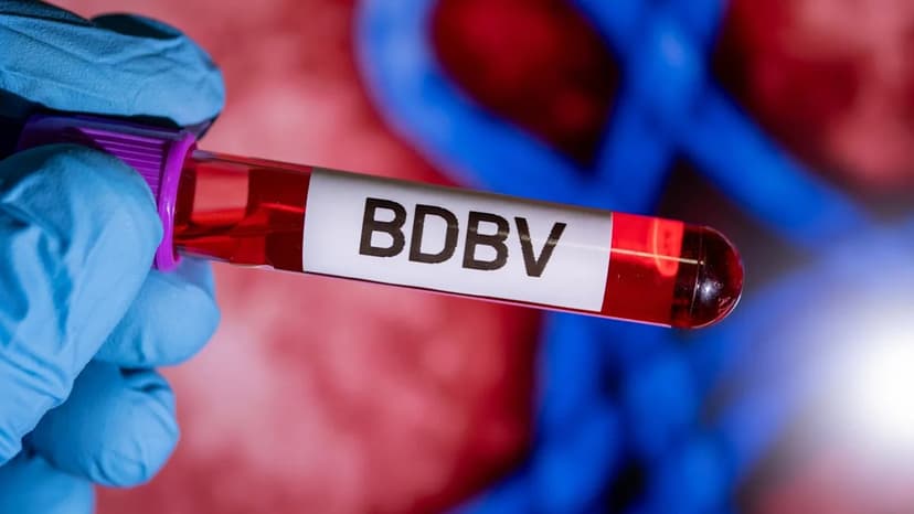 Roche Rushes Ebola Test Amid Outbreak Fears