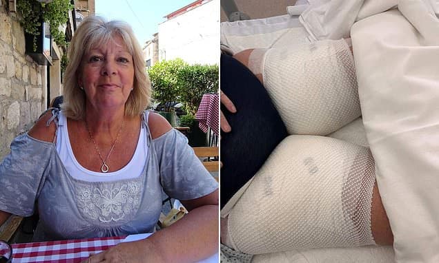 Ryanair Passenger Scarred After Scalding Tea Spill