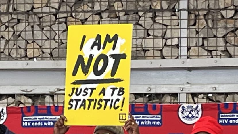 SA TB Research Faces Funding Cuts