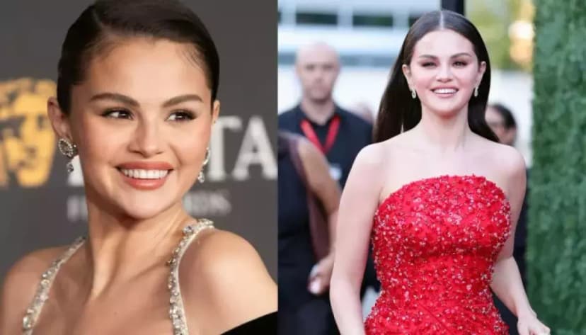 Selena Gomez's New Smile: Fans Speculate on Veneer Changes