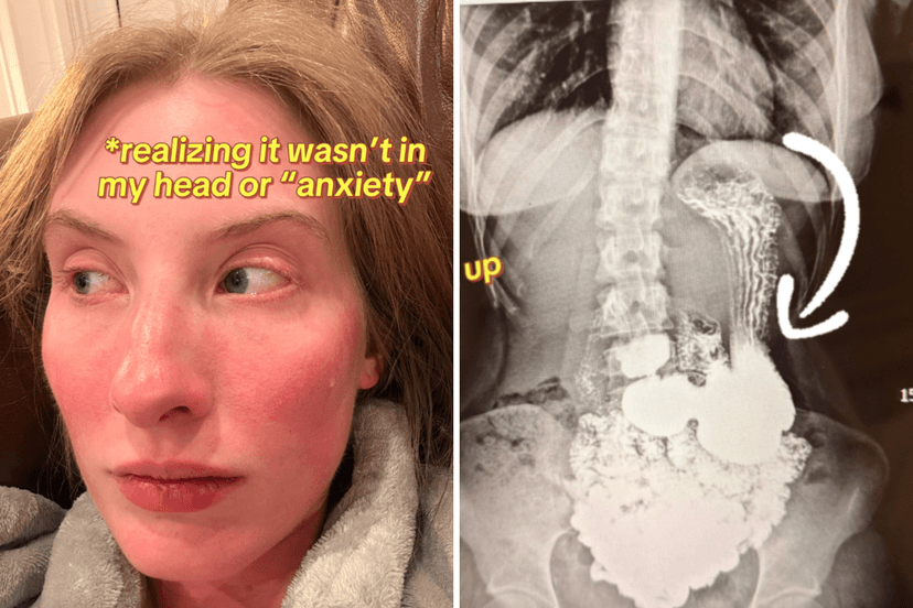 X-rays reveal shocking organ descent