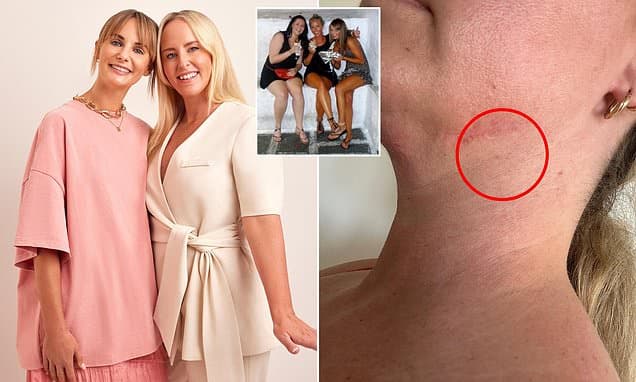 Skin Cancer Returns After Decade of Clear Scans