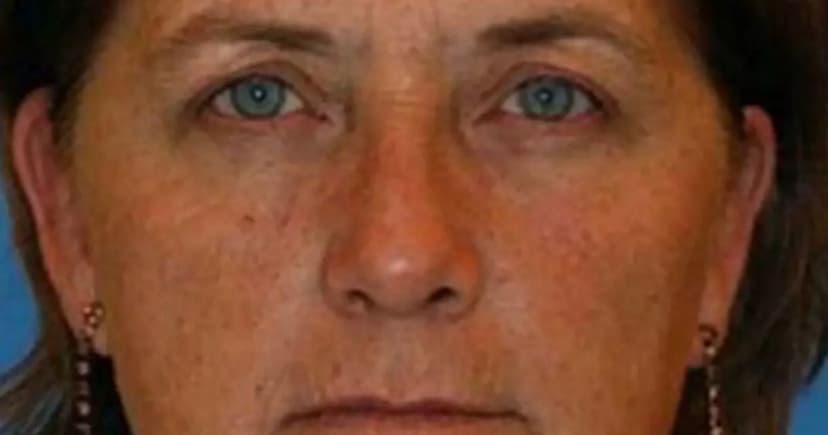 Smoking Ages Twins Differently: Shocking Visuals