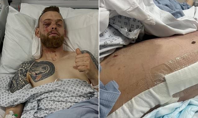 Speedway Star's Horrific Injuries After On-Track Crash
