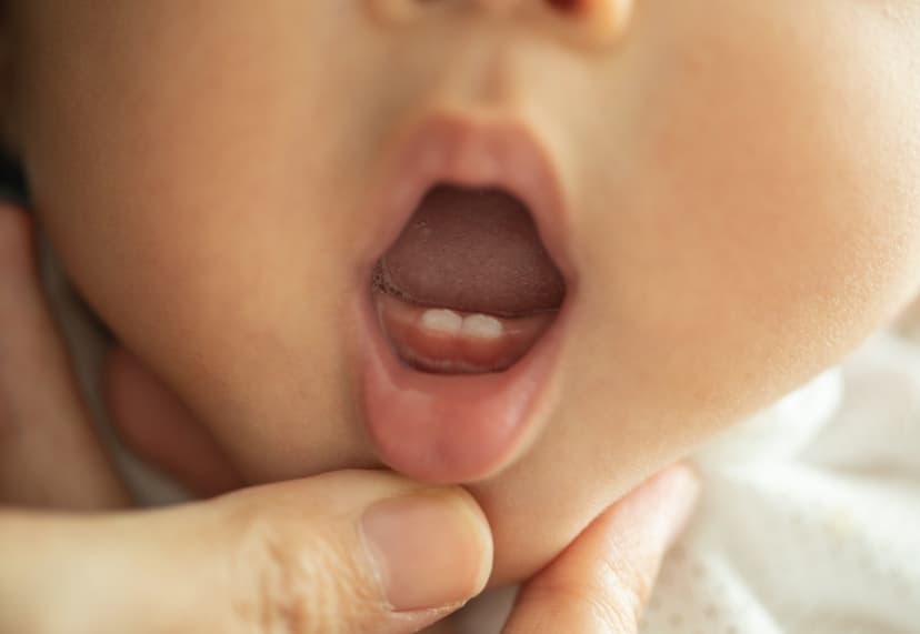 Stressed Moms' Babies Sprout Teeth Faster, Study Finds