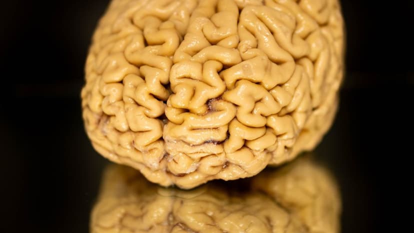 SuperAgers' Brains Double Young Neuron Growth