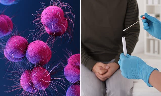 Superbug Gonorrhea Spreads: Urgent Sydney Warning Issued