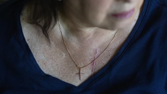 TAVR Heart Valve Failure: Younger Patients at Risk?