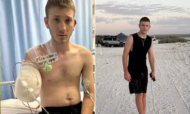 Teen Apprentice Loses Arm in Workshop Horror