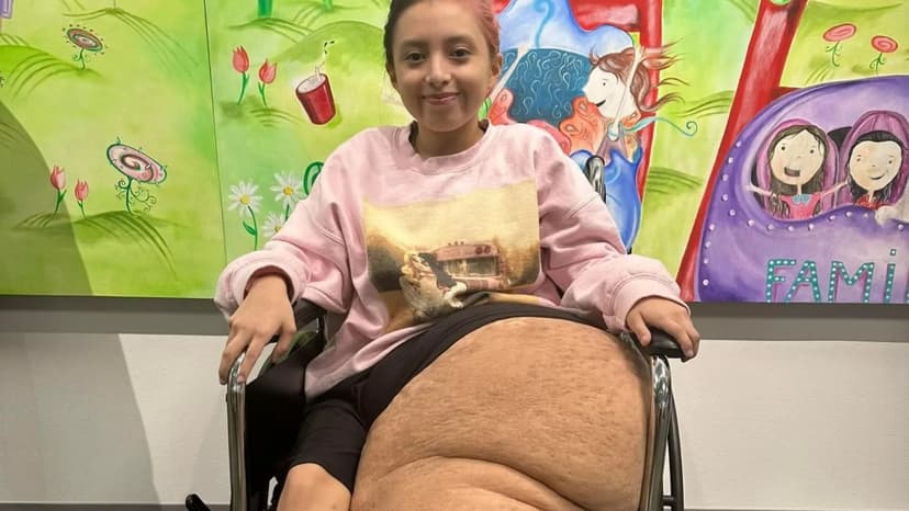 Girl's 12-Stone Leg Removed in 17-Hour Surgery