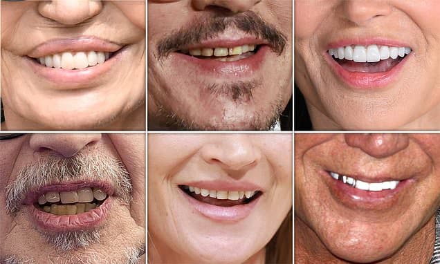 Smile Secrets: What Your Teeth Reveal About Age