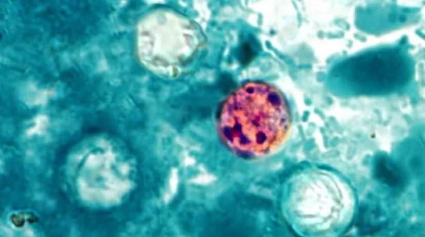 Texas Parasite Outbreak: Diarrhea Spreads