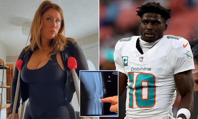 Model Claims Tyreek Hill Snapped Her Leg in Anger