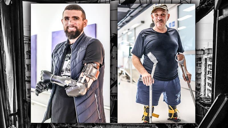 Ukraine's Brave Push: Prosthetics Forge New Futures